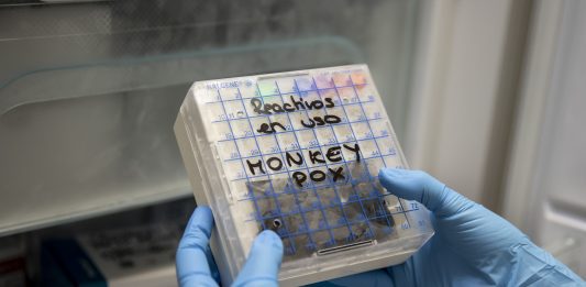 Monkeypox detected in Gauteng