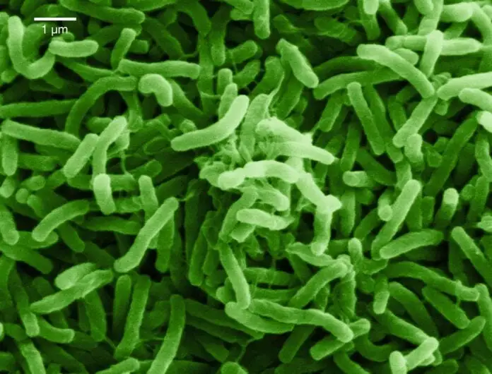 cholera bacteria