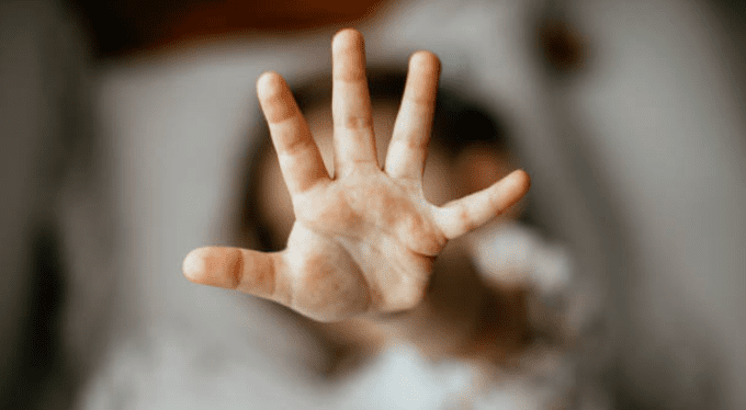 HIV treatment battles